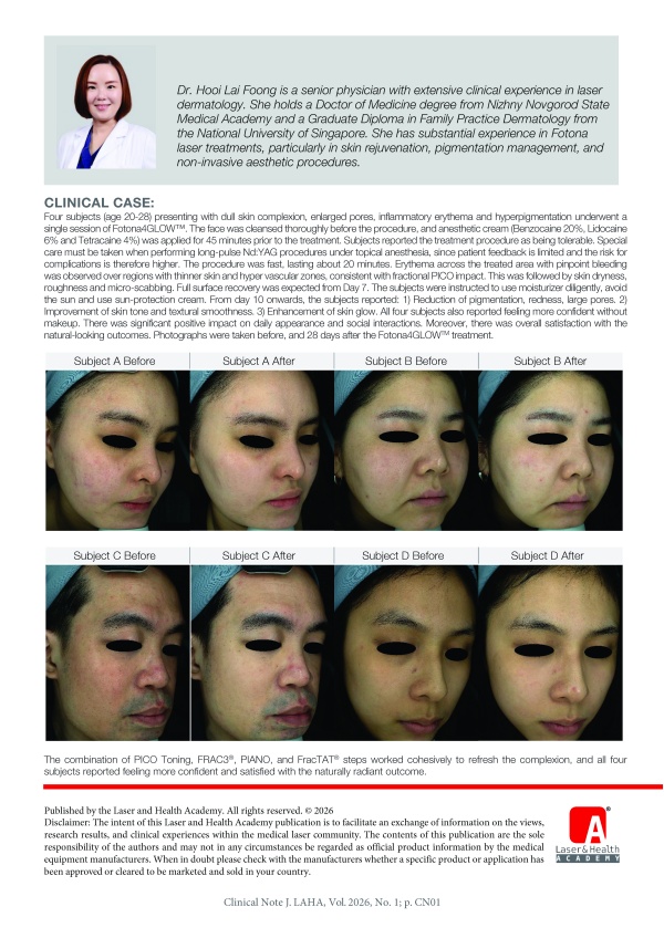 Fotona4GLOW™: Dual-Laser Synergy for Multi-Layer Skin Rejuvenation