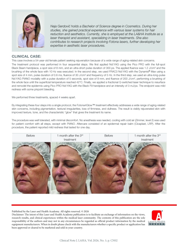 Fotona4GLOW™: A Multimodal Laser Protocol for the Treatment of Photodamaged Skin