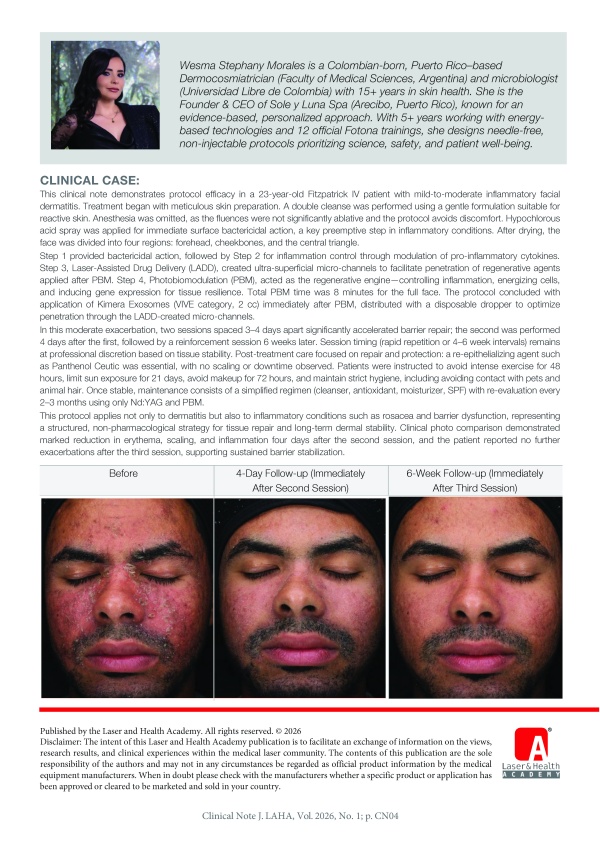 Protocol for Inflammatory Dermatitis Supported with PBM and LADD