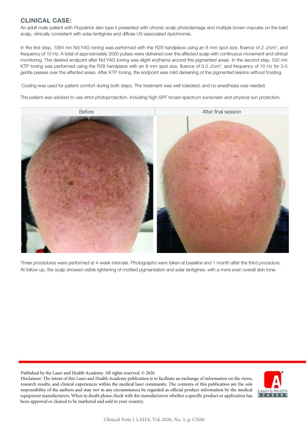 Green Toning: Q-switched Nd:YAG and KTP Laser Toning for Photodamaged Skin 