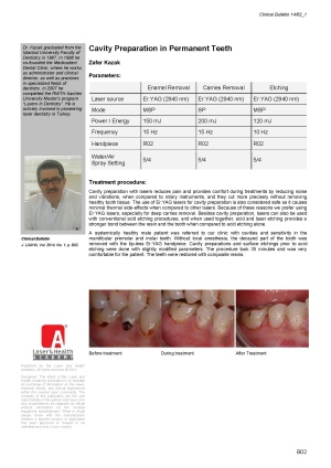 Cavity Preparation in Permanent Teeth