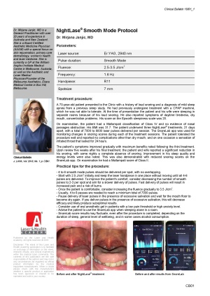 NightLase® Smooth Mode Protocol