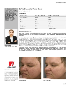 Er:YAG Laser for Acne Scars