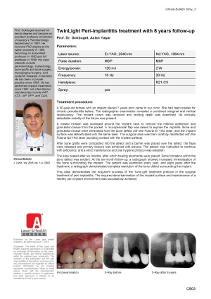 TwinLight Peri-implantitis Treatment with 8 Years Follow-Up