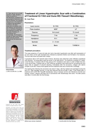 Treatment of Linear Hypertrophic Scar with a Combination of Fractional Er:YAG and Guna MD-Tissue® Mesotherapy