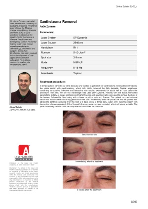 Xanthelasma Removal