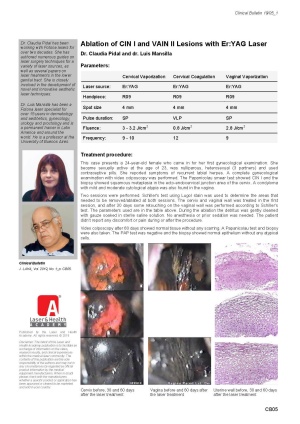 Ablation of CIN I and VAIN II Lesions with Er:YAG Laser