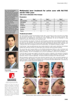 Multimodal laser treatment for active acne with Nd:YAG and Er:YAG Laser