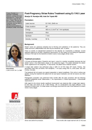 Post-Pregnancy Striae Rubra Treatment using Er:YAG Laser