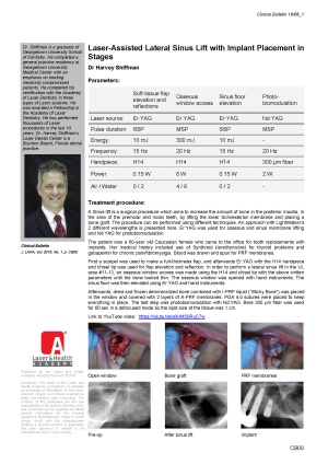 Laser-Assisted Lateral Sinus Lift with Implant Placement in Stages