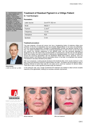 Treatment of Residual Pigment in a Vitiligo Patient