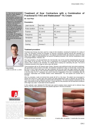 Treatment of Scar Contracture with a Combination of Fractional Er:YAG and Madecassol® 1% Cream