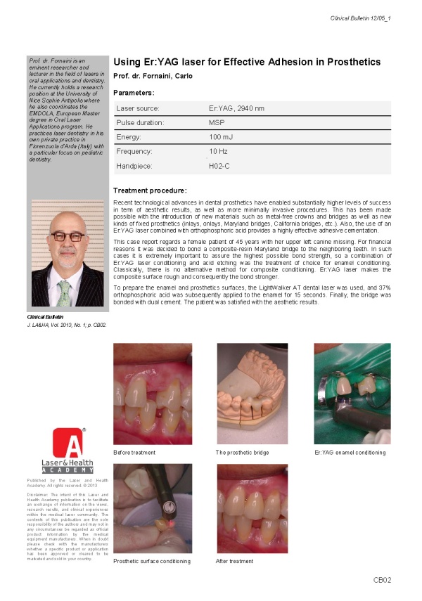 Using Er:YAG Laser for Effective Adhesion in Prosthetics