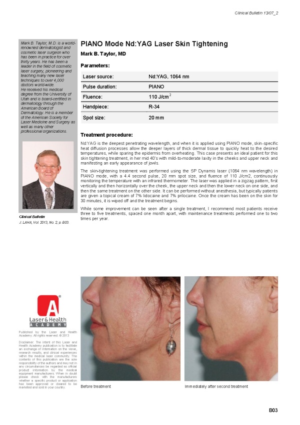 PIANO Mode Nd:YAG Laser Skin Tightening